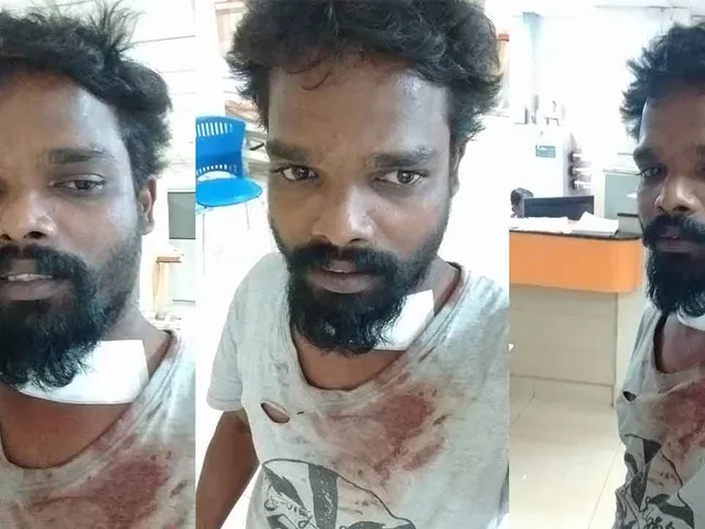 Bike Rider Attacked in Kochi