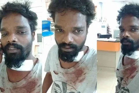 Bike Rider Attacked in Kochi