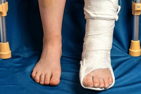 Lesson from a broken leg