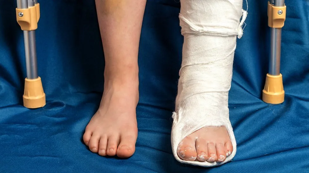 Lesson from a broken leg
